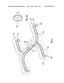 Melt Channel Geometries for an Injection Molding System diagram and image