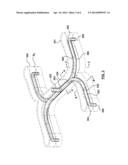 Melt Channel Geometries for an Injection Molding System diagram and image