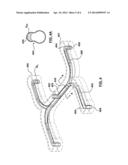 Melt Channel Geometries for an Injection Molding System diagram and image