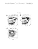 DETECTION OF TARGET NUCLEIC ACIDS IN A CELLULAR SAMPLE diagram and image