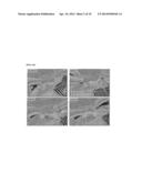 NOVEL USE OF C-TERMINAL DOMAIN OF IGFBP-5 COMPRISING HEPARIN-BINDING     DOMAIN AS AN ANGIOGENESIS INHIBITOR diagram and image