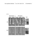 NOVEL USE OF C-TERMINAL DOMAIN OF IGFBP-5 COMPRISING HEPARIN-BINDING     DOMAIN AS AN ANGIOGENESIS INHIBITOR diagram and image