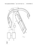 NAVIGATION DEVICE FOR BRACHYTHERAPY AND METHOD FOR OPERATING THE     NAVIGATION DEVICE diagram and image