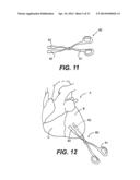 TRANSVENTRICULAR IMPLANT TOOLS AND DEVICES diagram and image