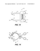 TRANSVENTRICULAR IMPLANT TOOLS AND DEVICES diagram and image