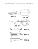 TRANSVENTRICULAR IMPLANT TOOLS AND DEVICES diagram and image