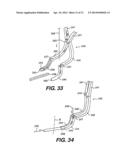 TRANSVENTRICULAR IMPLANT TOOLS AND DEVICES diagram and image