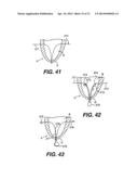 TRANSVENTRICULAR IMPLANT TOOLS AND DEVICES diagram and image