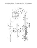 TRANSVENTRICULAR IMPLANT TOOLS AND DEVICES diagram and image