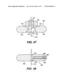 TRANSVENTRICULAR IMPLANT TOOLS AND DEVICES diagram and image