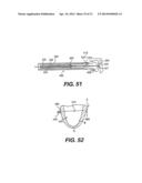 TRANSVENTRICULAR IMPLANT TOOLS AND DEVICES diagram and image