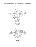 TRANSVENTRICULAR IMPLANT TOOLS AND DEVICES diagram and image