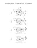 METHOD OF PLACING MEDICAL INSERTION INSTRUMENTS IN BODY CAVITY diagram and image