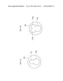 METHOD OF PLACING MEDICAL INSERTION INSTRUMENTS IN BODY CAVITY diagram and image