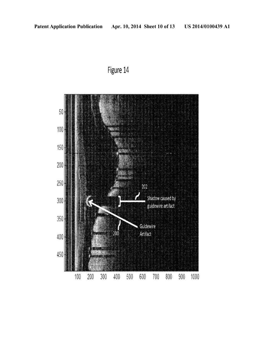 GUIDEWIRE ARTIFACT REMOVAL IN IMAGES - diagram, schematic, and image 11