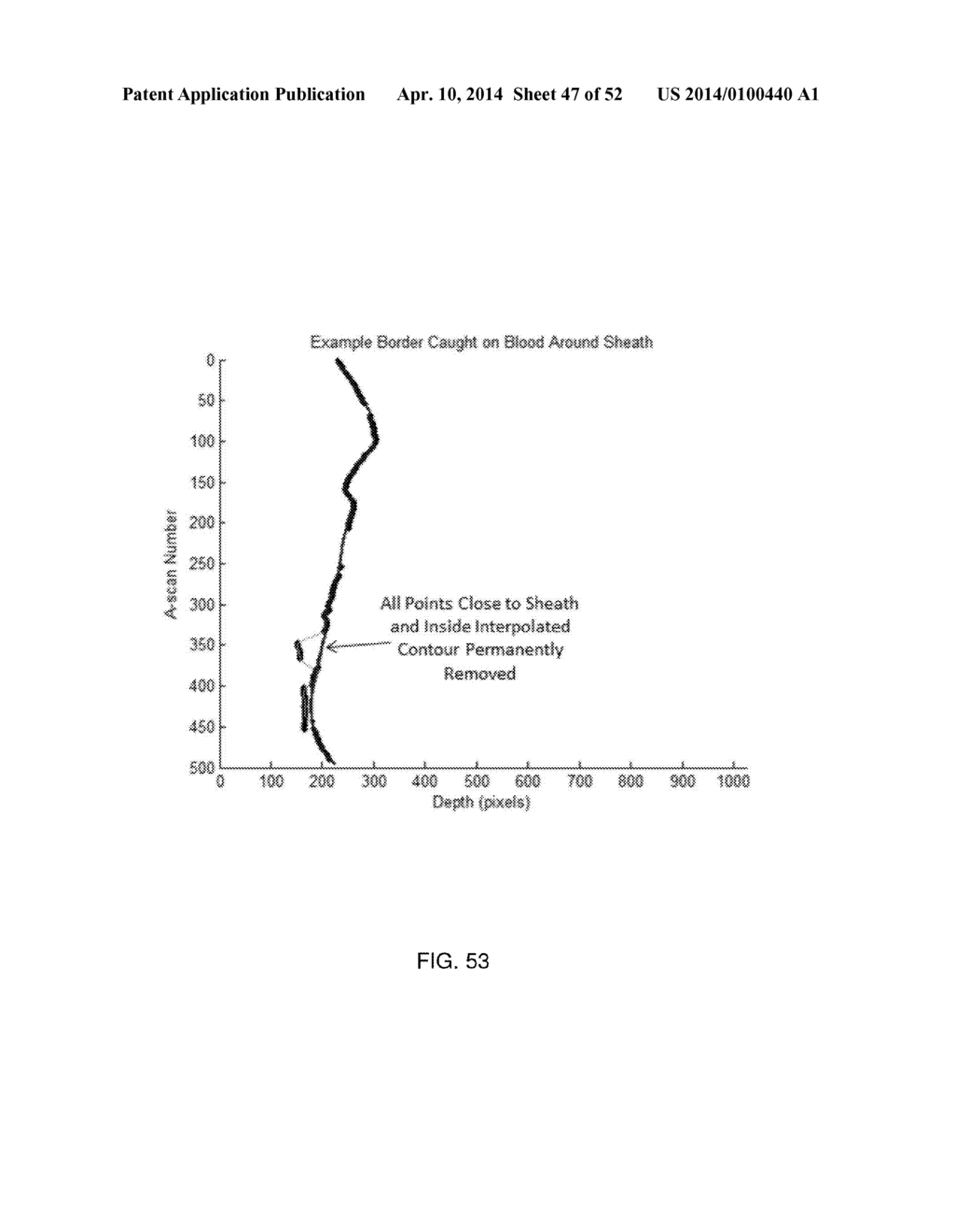 SYSTEM AND METHOD FOR INSTANT AND AUTOMATIC BORDER DETECTION - diagram, schematic, and image 48