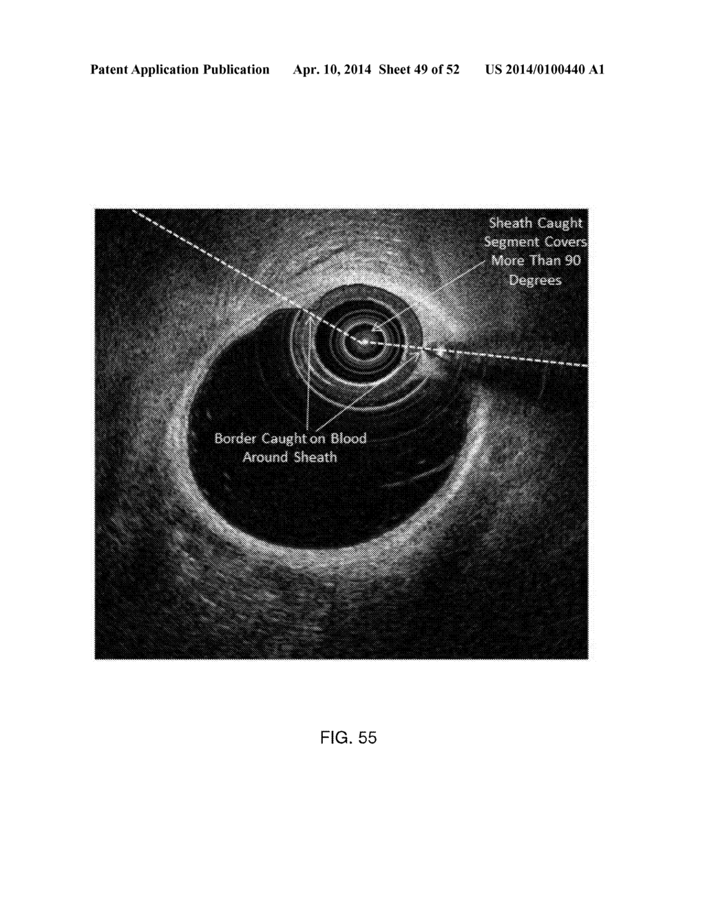 SYSTEM AND METHOD FOR INSTANT AND AUTOMATIC BORDER DETECTION - diagram, schematic, and image 50