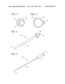 VEIN CLOSURE AND INJECTION KITS AND METHODS diagram and image