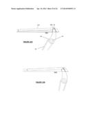 Plastic Surgical Instruments diagram and image