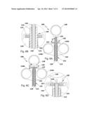 DEVICE FOR SEALING PERFORATIONS AND SUSTAINING FLOW diagram and image