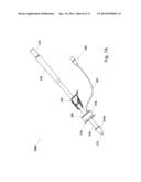 DEVICE FOR SEALING PERFORATIONS AND SUSTAINING FLOW diagram and image