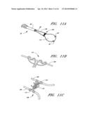 METHOD OF CLOSING AN OPENING IN A WALL OF THE HEART diagram and image