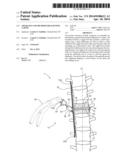 APPARATUS AND METHOD FOR ALIGNING A SPINE diagram and image