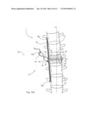 APPARATUS AND METHOD FOR ALIGNING A SPINE diagram and image