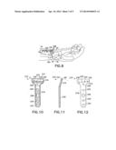 Volar Fixation System and Methods of Using the Same diagram and image