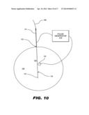 IMPLANTABLE STIMULATOR diagram and image