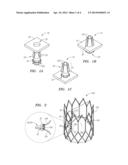 Medical Device Fastener Mechanisms diagram and image