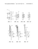 Medical Device Fastener Mechanisms diagram and image