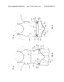 GARMENT WITH TETHERING SYSTEM diagram and image