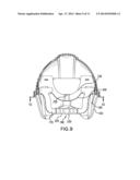 PROTECTIVE HEADGEAR ASSEMBLY diagram and image