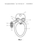 BIDET WASHING APPARATUS diagram and image