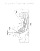 Closed Automated Suction Device and Method diagram and image