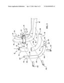 Reinforcement Structure for a Vehicle Fuel Filler Tube diagram and image