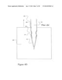 NON-CORING REDUCED SHEARING NEEDLE diagram and image