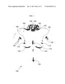 ANATOMICAL RECOGNITION, ORIENTATION AND DISPLAY OF AN UPPER TORSO TO     ASSIST BREAST SURGERY diagram and image