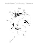 ANATOMICAL RECOGNITION, ORIENTATION AND DISPLAY OF AN UPPER TORSO TO     ASSIST BREAST SURGERY diagram and image