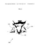 ANATOMICAL RECOGNITION, ORIENTATION AND DISPLAY OF AN UPPER TORSO TO     ASSIST BREAST SURGERY diagram and image