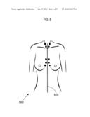 ANATOMICAL RECOGNITION, ORIENTATION AND DISPLAY OF AN UPPER TORSO TO     ASSIST BREAST SURGERY diagram and image