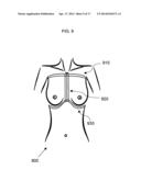 ANATOMICAL RECOGNITION, ORIENTATION AND DISPLAY OF AN UPPER TORSO TO     ASSIST BREAST SURGERY diagram and image