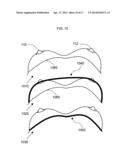 ANATOMICAL RECOGNITION, ORIENTATION AND DISPLAY OF AN UPPER TORSO TO     ASSIST BREAST SURGERY diagram and image