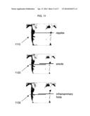 ANATOMICAL RECOGNITION, ORIENTATION AND DISPLAY OF AN UPPER TORSO TO     ASSIST BREAST SURGERY diagram and image