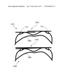 ANATOMICAL RECOGNITION, ORIENTATION AND DISPLAY OF AN UPPER TORSO TO     ASSIST BREAST SURGERY diagram and image