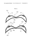 ANATOMICAL RECOGNITION, ORIENTATION AND DISPLAY OF AN UPPER TORSO TO     ASSIST BREAST SURGERY diagram and image