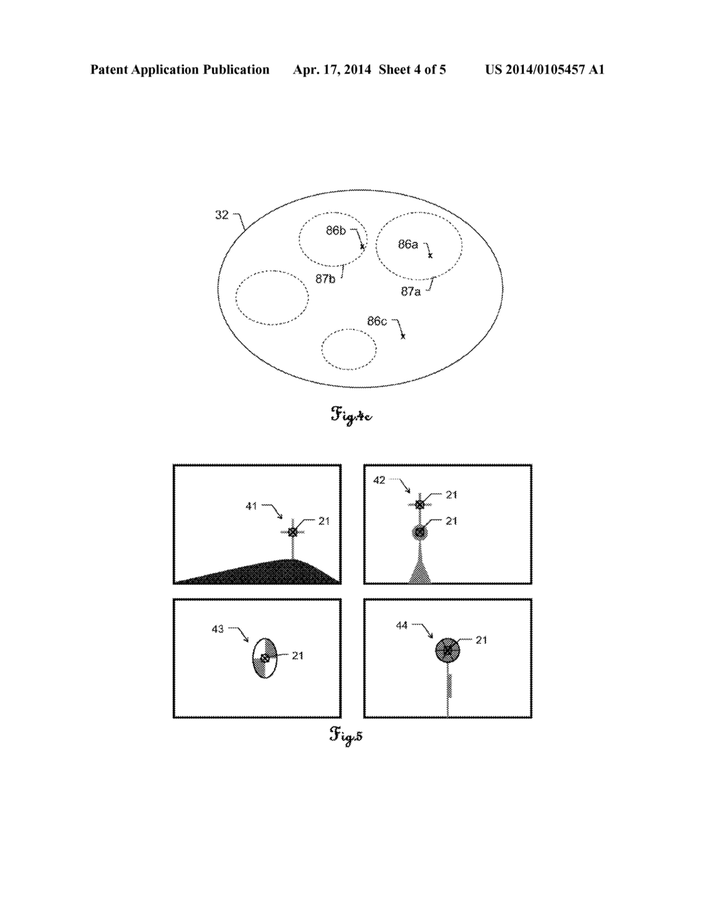 METHOD FOR PROVIDING TARGET POINT CANDIDATES FOR SELECTING A TARGET POINT - diagram, schematic, and image 05