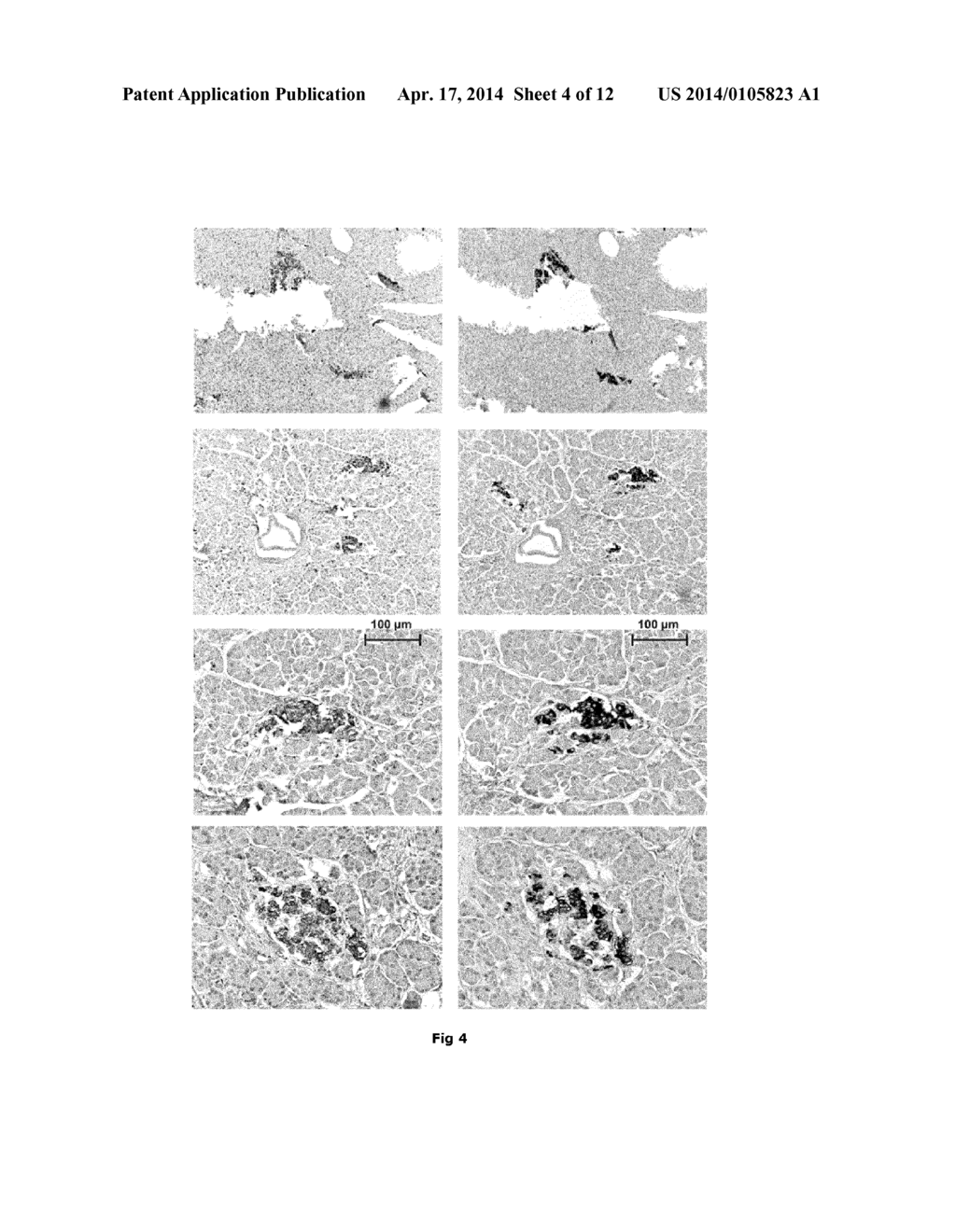 MOLECULES SPECIFICALLY BINDING PANCREATIC BETA CELLS BIOMARKERS - diagram, schematic, and image 05