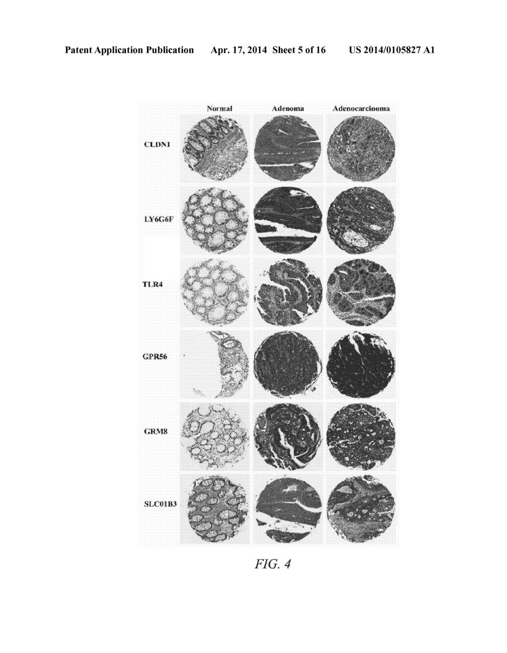 METHOD OF SCREENING FOR COLON CANCER USING BIOMARKERS - diagram, schematic, and image 06